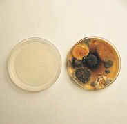 Nasty Germs in a Petri Dish